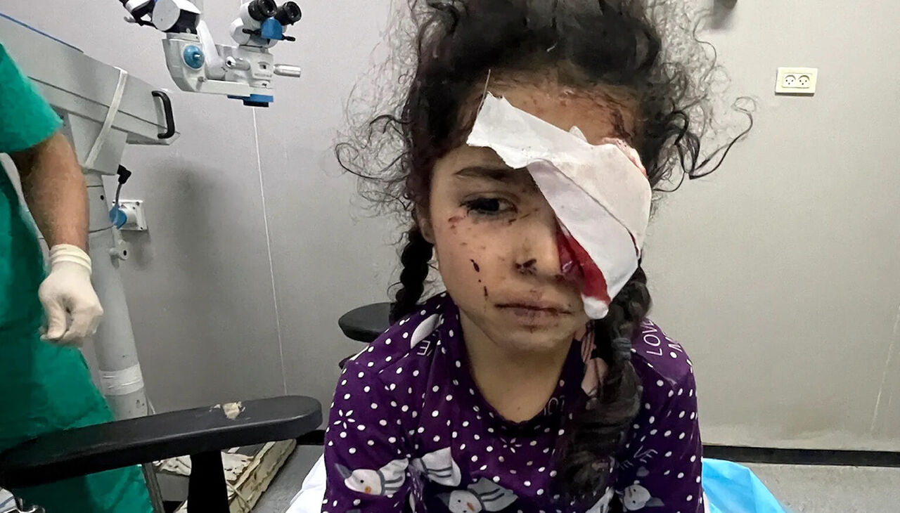 وزارة الصحة الفلسطينية: 1500 فلسطيني فقدوا البصر جراء حرب الإبادة في قطاع غزة